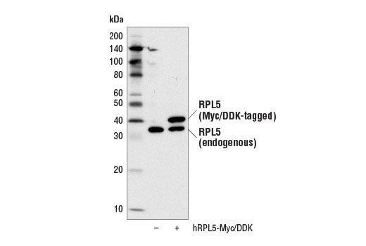 Western Blotting Image 2: RPL5 Antibody