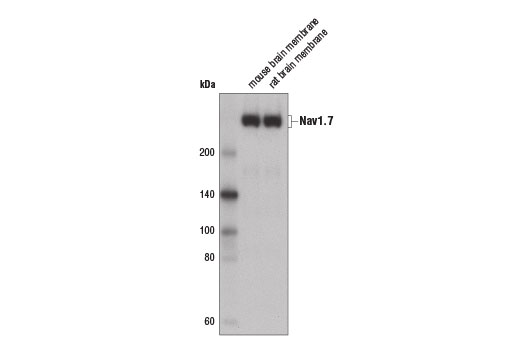 Western Blotting Image 1: Nav1.7 Antibody
