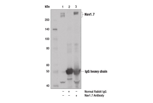 Immunoprecipitation Image 1: Nav1.7 Antibody