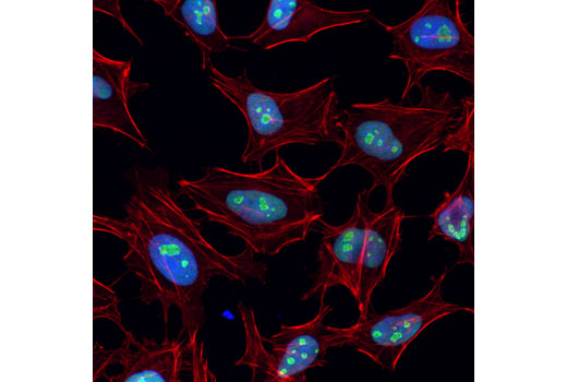 Immunofluorescence Image 1: Nucleolin (D4C7O) Rabbit mAb