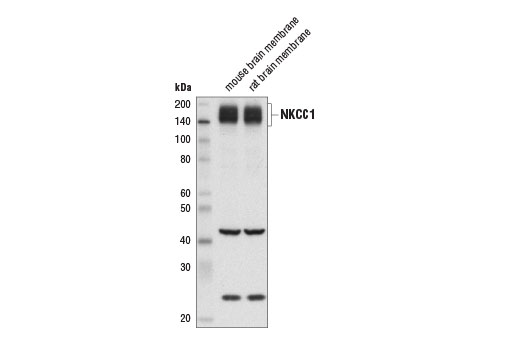 Western Blotting Image 1: NKCC1 Antibody