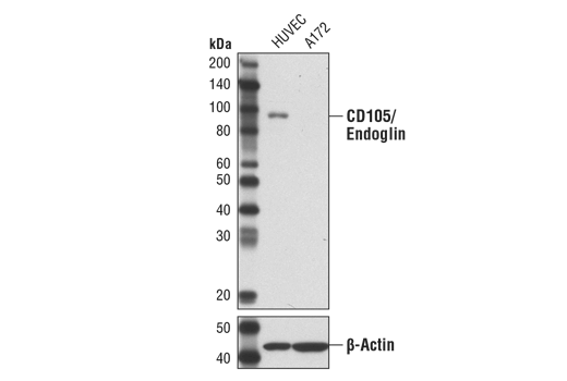 Western Blotting Image 1: CD105/Endoglin (3A9) Mouse mAb