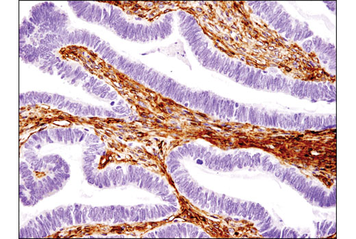 Immunohistochemistry Image 3: CD105/Endoglin (3A9) Mouse mAb