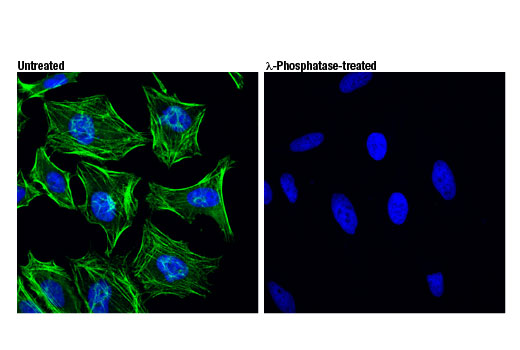 Immunofluorescence Image 1: Phospho-Myosin IIa (Ser1943) (D7Z7T) Rabbit mAb