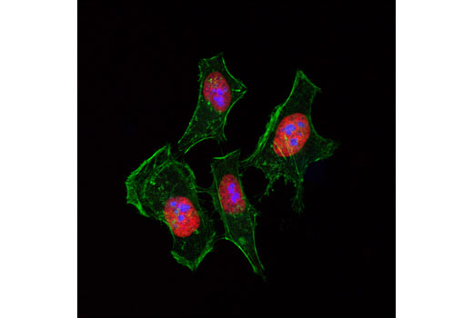 Immunofluorescence Image 1: Fibrillarin (C13C3) Rabbit mAb (Alexa Fluor® 647 Conjugate)