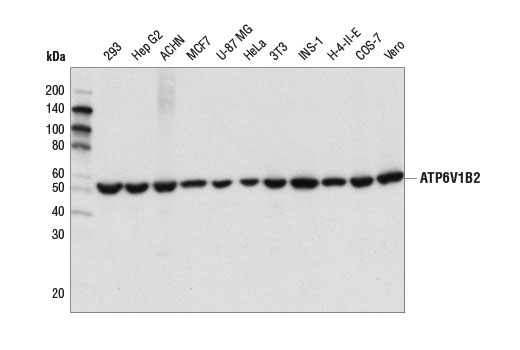 Western Blotting Image 1: ATP6V1B2 (D2F9R) Rabbit mAb