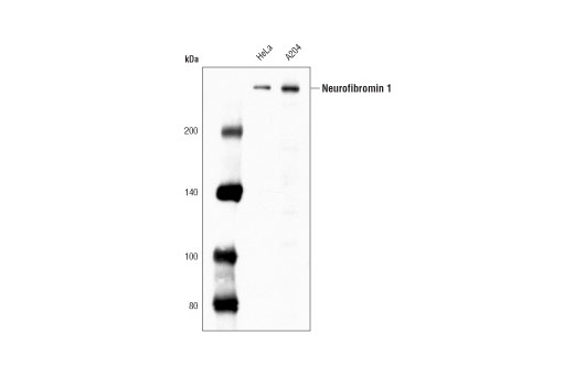 Western Blotting Image 1: Neurofibromin 1 (D7R7D) Rabbit mAb