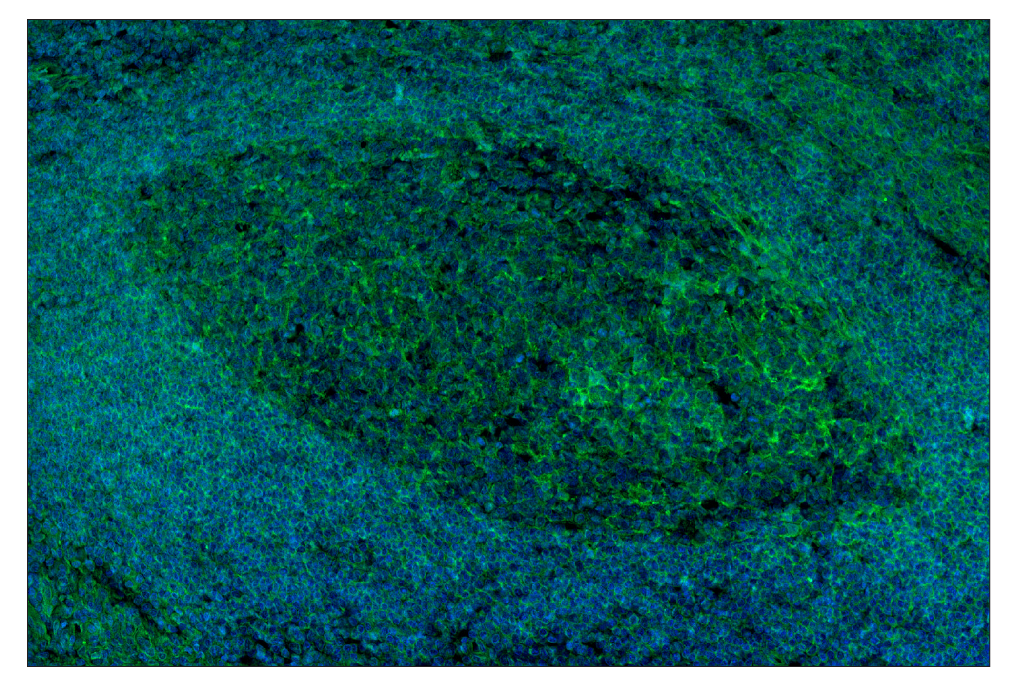 Immunohistochemistry Image 1: NT5E/CD73 (D7F9A) Rabbit mAb (Alexa Fluor® 488 Conjugate)