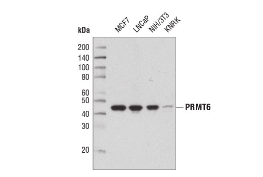  Image 2: PRMT Antibody Sampler Kit
