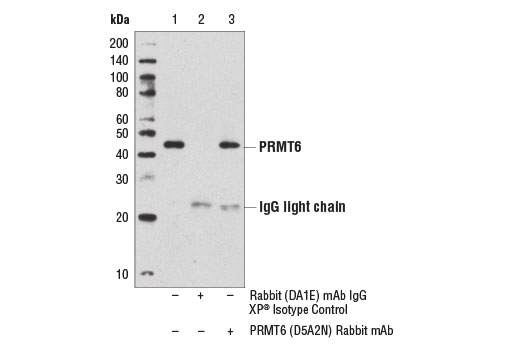  Image 11: PRMT Antibody Sampler Kit