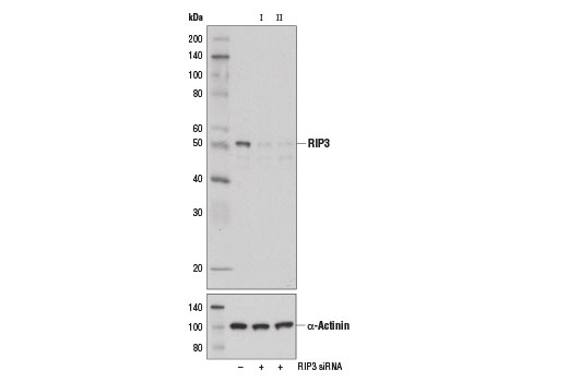  Image 1: SignalSilence® RIP3 siRNA I (Mouse Specific)