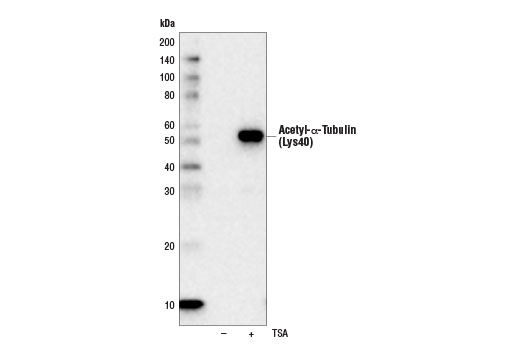 Western Blotting Image 1: Acetyl-α-Tubulin (Lys40) (D20G3) XP® Rabbit mAb (HRP Conjugate)