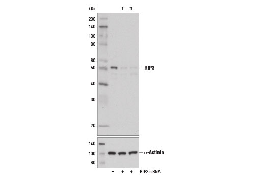  Image 1: SignalSilence® RIP3 siRNA II (Mouse Specific)