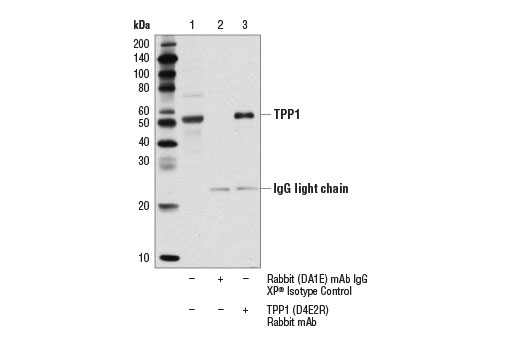 Immunoprecipitation Image 1: TPP1 (D4E2R) Rabbit mAb