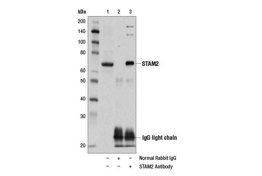 Immunoprecipitation Image 1: STAM2 Antibody