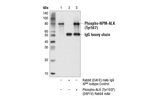 Immunoprecipitation Image 1: Phospho-ALK (Tyr1507) (D6F1V) Rabbit mAb