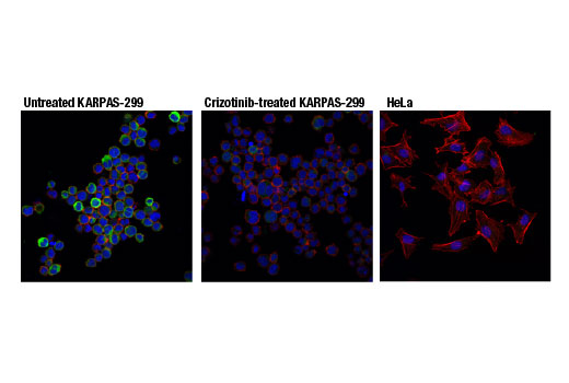 Immunofluorescence Image 1: Phospho-ALK (Tyr1507) (D6F1V) Rabbit mAb