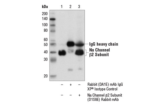 Immunoprecipitation Image 1: Na Channel β2 Subunit (D1S8E) Rabbit mAb