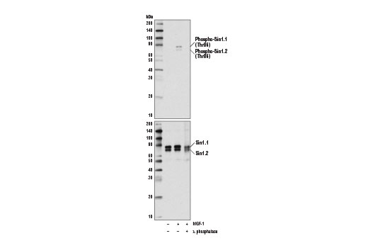  Image 4: PhosphoPlus® Sin1 (Thr86) Antibody Duet