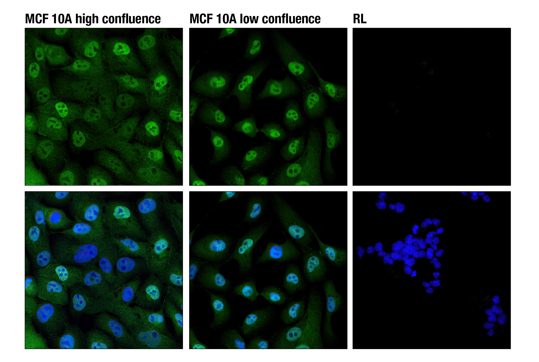 Immunofluorescence Image 1: YAP (D8H1X) XP® Rabbit mAb (Alexa Fluor® 488 Conjugate)