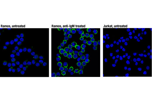 Immunofluorescence Image 1: Phospho-CD79A (Tyr182) (D1B9) Rabbit mAb