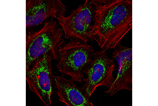  Image 24: Mitochondrial Dynamics Antibody Sampler Kit II