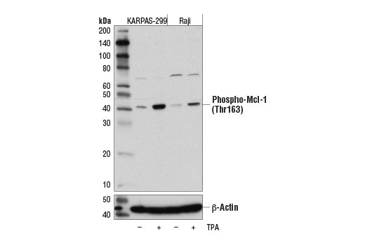Western Blotting Image 1: Phospho-Mcl-1 (Thr163) (D5M9D) Rabbit mAb