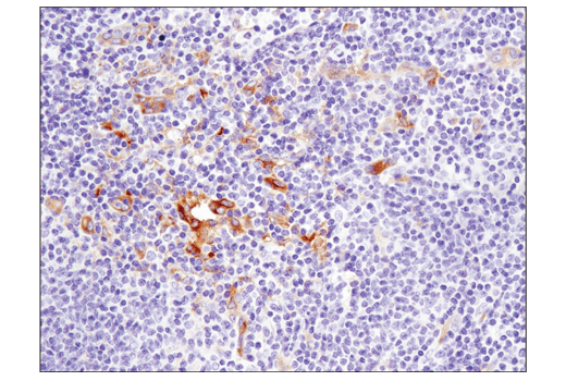 Immunohistochemistry Image 6: IFIT1 (D2X9Z) Rabbit mAb