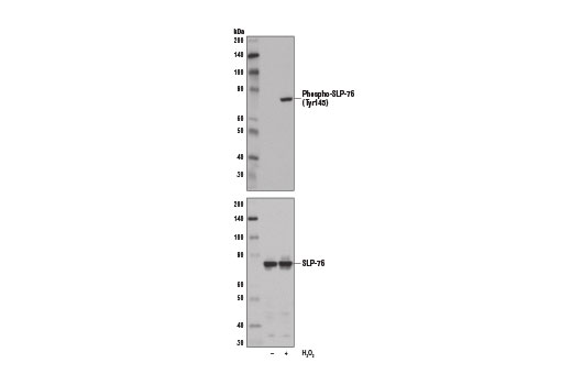 Western Blotting Image 1: Phospho-SLP-76 (Tyr145) Antibody