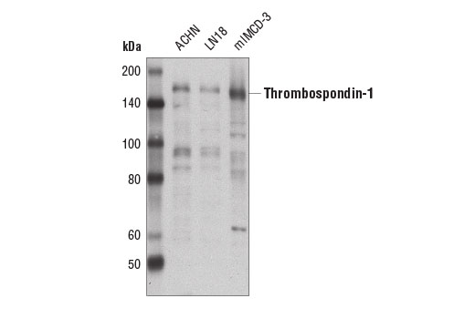 Western Blotting Image 1: Thrombospondin-1 Antibody