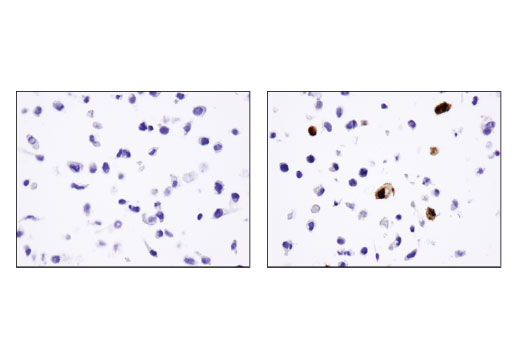 Immunohistochemistry Image 1: DYKDDDDK Tag (D6W5B) Rabbit mAb (Binds to same epitope as Sigma's Anti-FLAG® M2 Antibody)