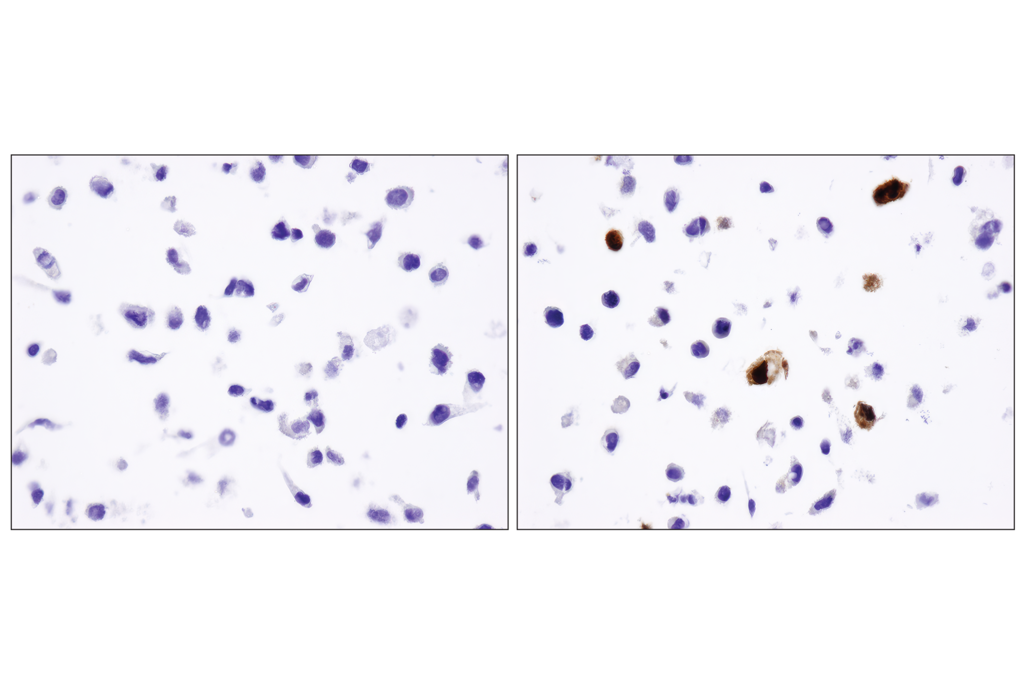 Immunohistochemistry Image 1: DYKDDDDK Tag (D6W5B) Rabbit mAb (Binds to same epitope as Sigma-Aldrich Anti-FLAG M2 antibody)