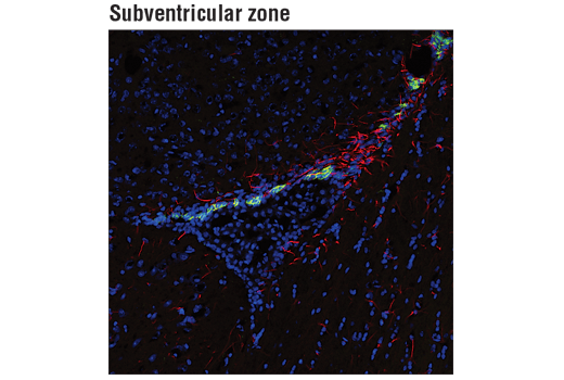  Image 9: Neuronal Marker IF Antibody Sampler Kit II