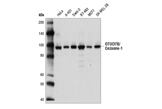 Western Blotting Image 1: OTUD7B/Cezanne-1 Antibody