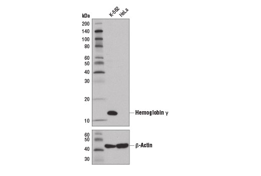 Western Blotting Image 1: Hemoglobin γ Antibody