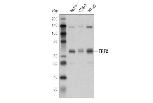 Western Blotting Image 1: TRF2 (P449) Antibody