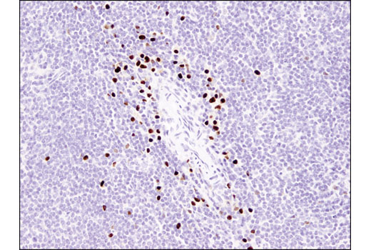 Immunohistochemistry Image 4: MIST1/bHLHa15 (D7N4B) XP® Rabbit mAb