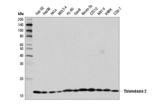  Image 3: Redox Homeostasis and Signaling Antibody Sampler Kit