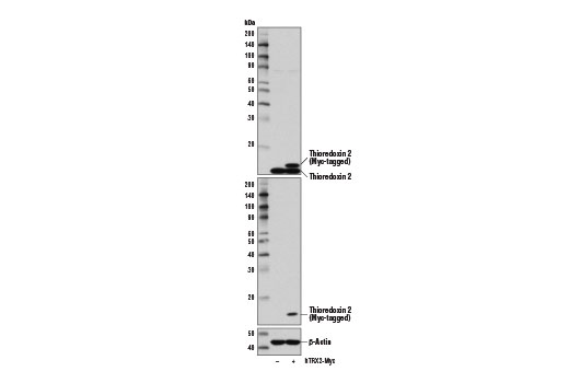 Image 12: Redox Homeostasis and Signaling Antibody Sampler Kit
