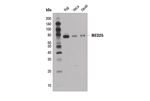  Image 2: Mediator Complex Antibody Sampler Kit