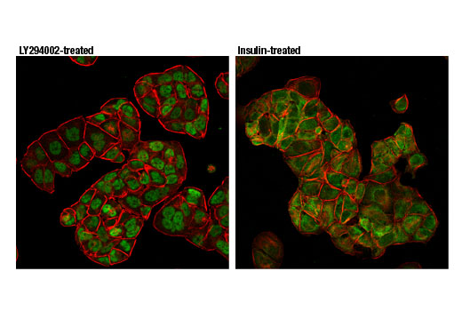 Immunofluorescence Image 1: FoxO1 (D7C1H) Mouse mAb