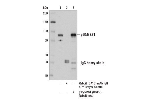 Immunoprecipitation Image 1: p95/NBS1 (D6J5I) Rabbit mAb
