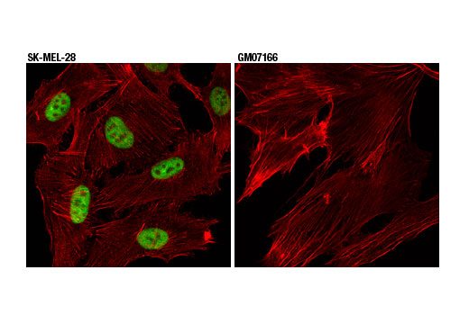 Immunofluorescence Image 1: p95/NBS1 (D6J5I) Rabbit mAb