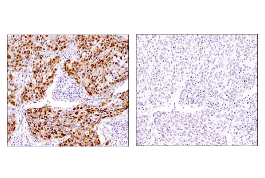 Immunohistochemistry Image 4: Sox2 (D1C7J) XP® Rabbit mAb