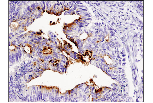 Immunohistochemistry Image 1: TIM-1 (E1R9N) Rabbit mAb