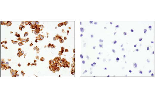 Immunohistochemistry Image 3: TIM-1 (E1R9N) Rabbit mAb