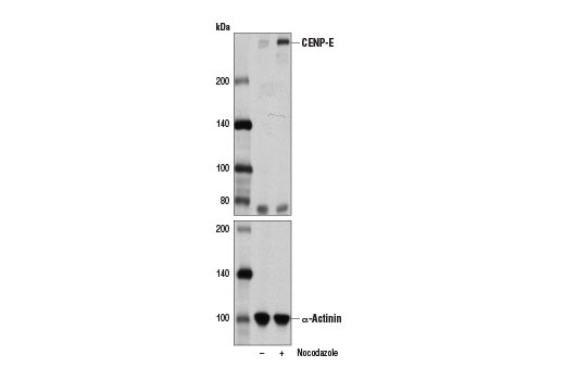 Western Blotting Image 2: CENP-E Antibody