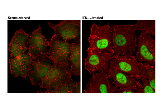 Immunofluorescence Image 1: Stat1 (D1K9Y) Rabbit mAb