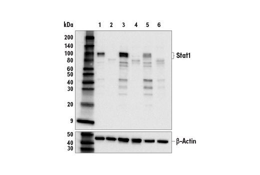  Image 41: Type I Interferon Induction and Signaling Antibody Sampler Kit