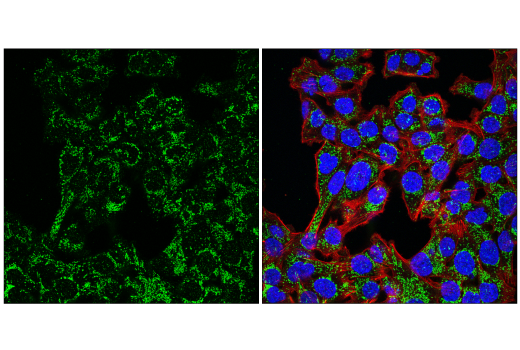 Immunofluorescence Image 3: MCU (D2Z3B) Rabbit mAb
